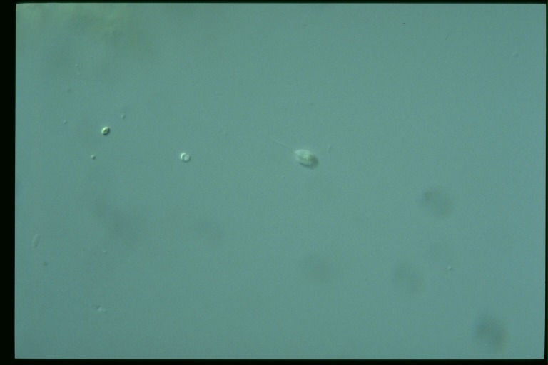 protist image