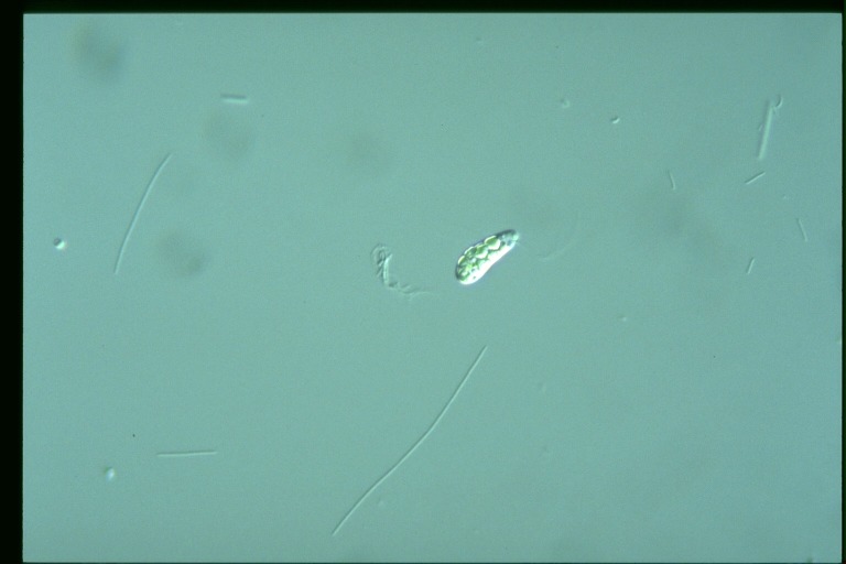 protist image