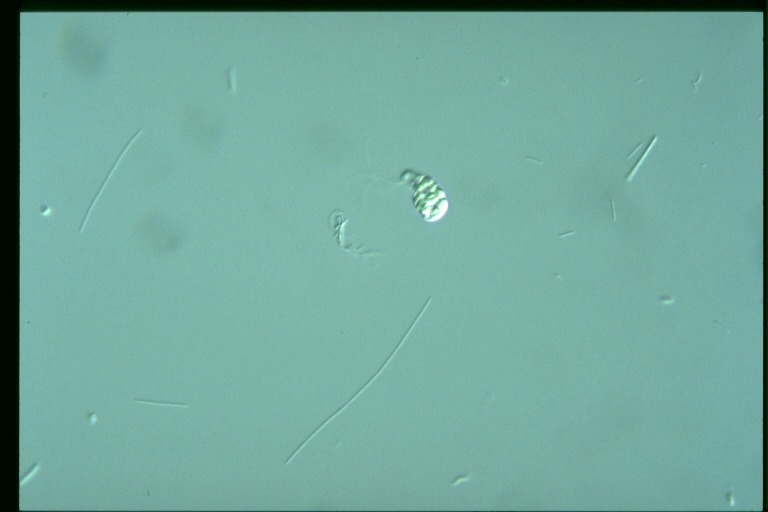 protist image