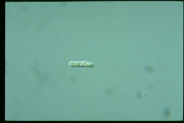 protist image