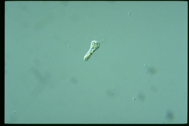 protist image