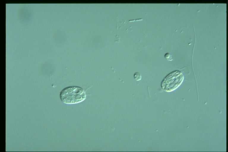 protist image