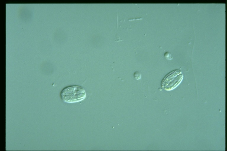 protist image