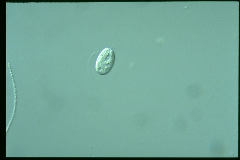 protist image