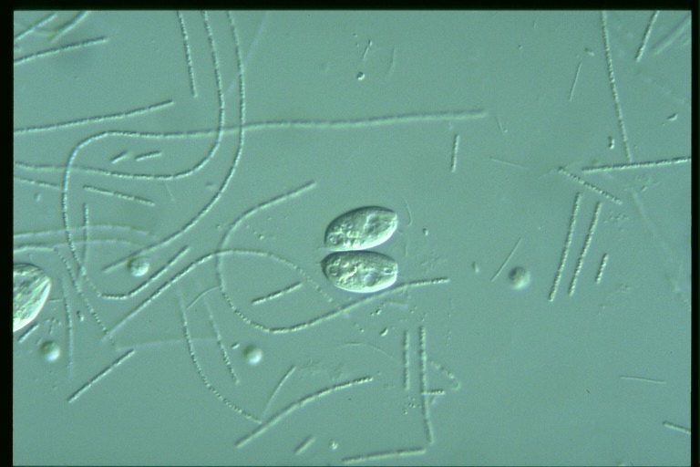 protist image