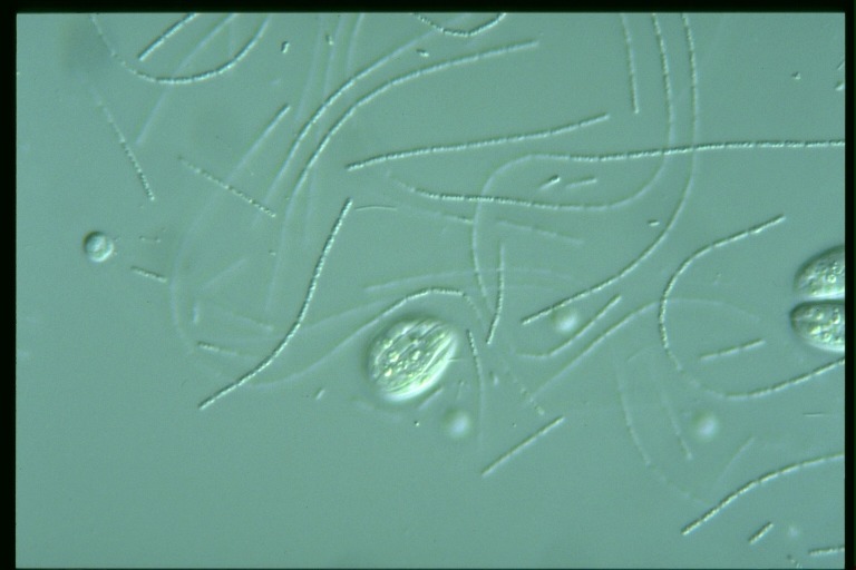 protist image