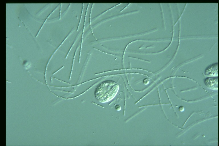 protist image