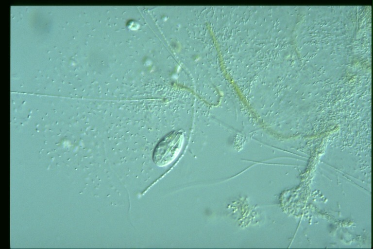 protist image