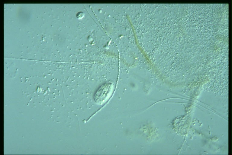 protist image