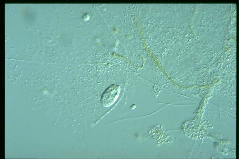 protist image