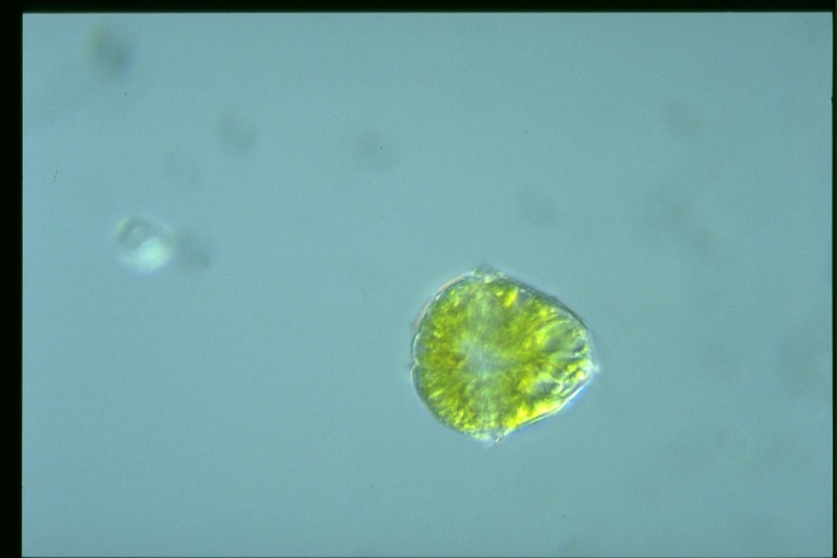 protist image