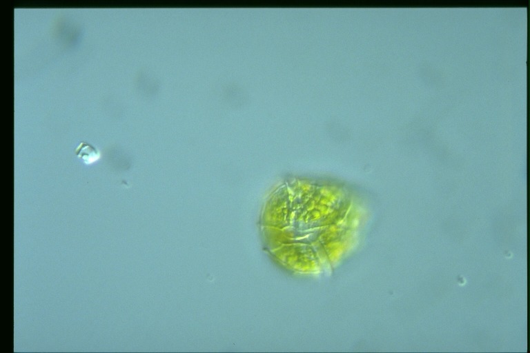 protist image