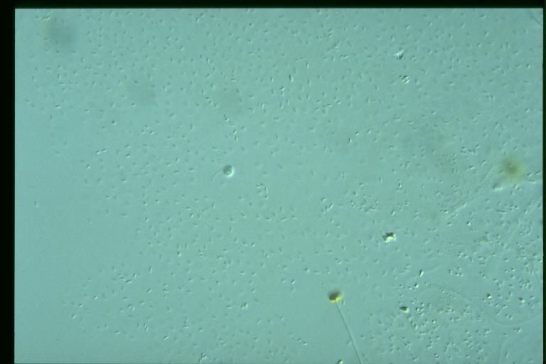 protist image