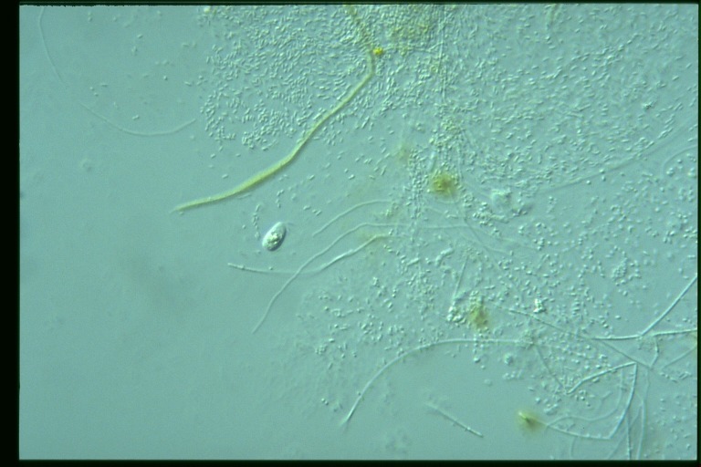 protist image