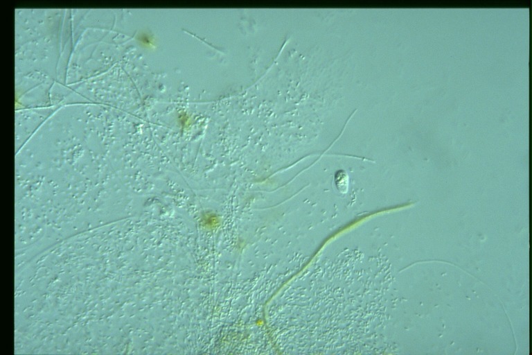 protist image