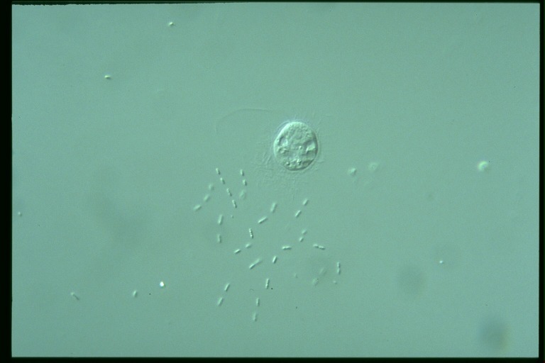 protist image