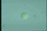 Acanthocystis