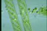 Spirogyra