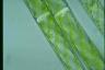 Spirogyra