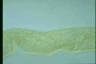 Spirostomum ambiguum