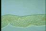 Spirostomum ambiguum