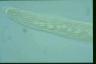 Spirostomum ambiguum