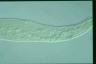 Spirostomum ambiguum