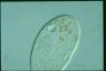 Paramecium duboscqui