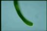 Euglena ehrenbergii