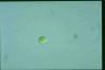 Haematococcus