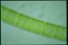 Spirogyra