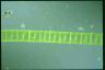 Spirogyra