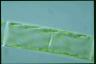 Spirogyra