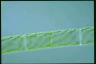 Spirogyra