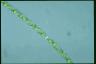 Spirogyra