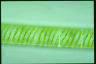 Spirogyra