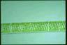 Spirogyra