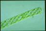 Spirogyra