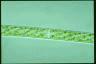 Spirogyra