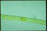 Spirogyra