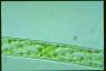 Spirogyra