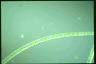 Spirogyra