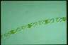 Spirogyra