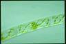 Spirogyra