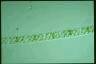 Spirogyra