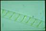 Spirogyra