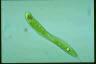 Euglena oxyuris