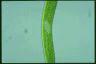 Euglena ehrenbergii