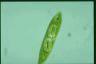 Euglena spirogyra