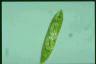 Euglena spirogyra